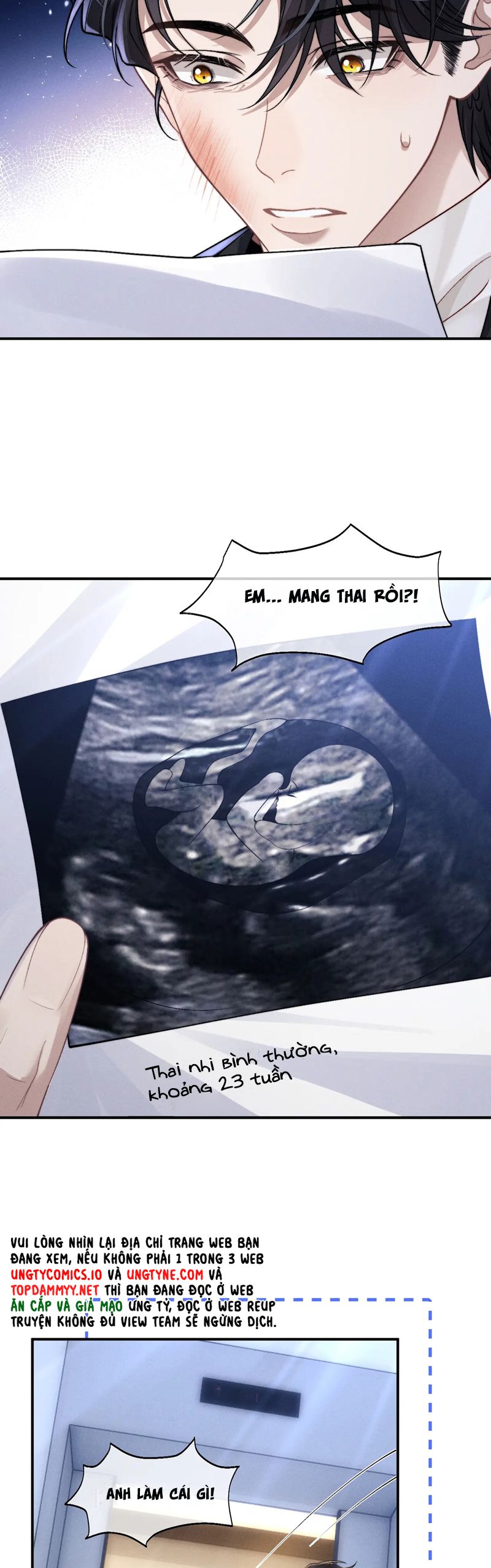 Chấp Sự Thỏ Cụp Tai Chapter 130 - Next Chapter 131