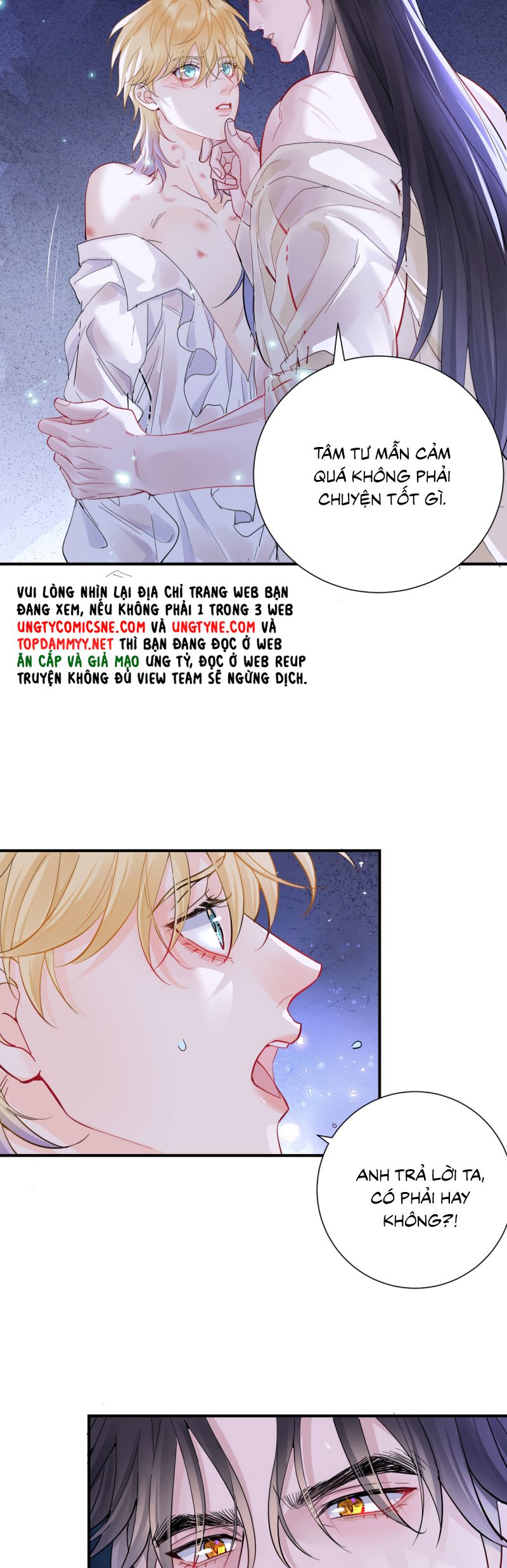 Bản Tình Ca Nụ Hôn Tù Ái Chap 35 - Trang 2